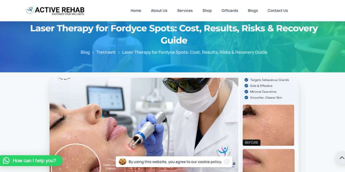 Laser Treatment for Fordyce Spots Cost: Can You Get Smoother Skin Without Overspending?