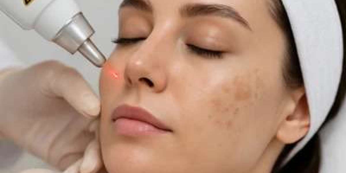 Pigmentation Treatment in Dubai: Personalised Solutions for Skin Discolouration